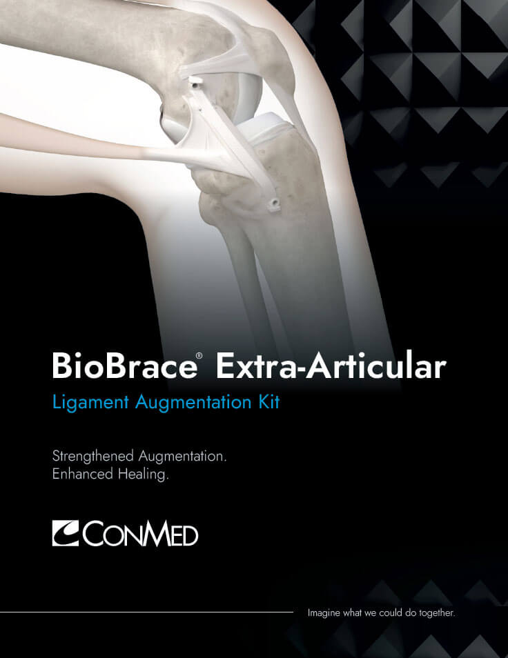 Brochure cover for BioBrace Extra-Articular Ligament Augmentation Kit