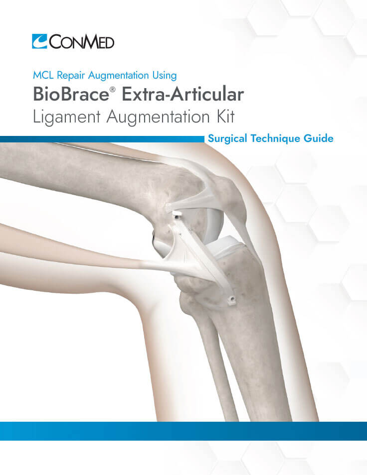 Surgical Technigue Guide cover