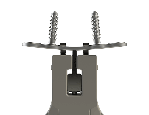 Animated gig of NeoSpan Solo-in-One product