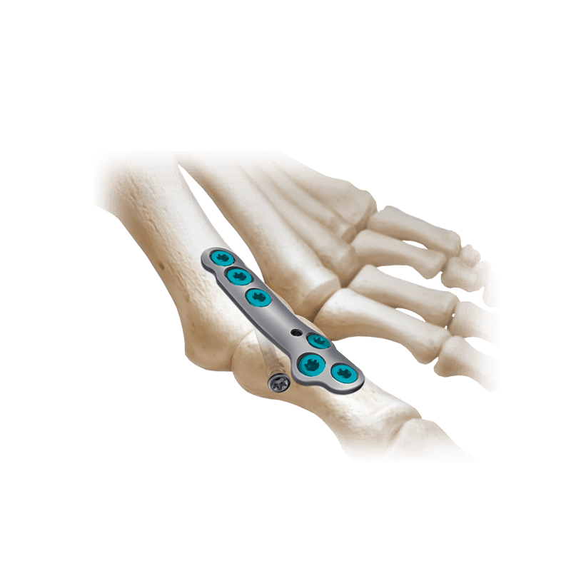 Sistema de placas de compresión CoLink<sup>&reg;</sup>2