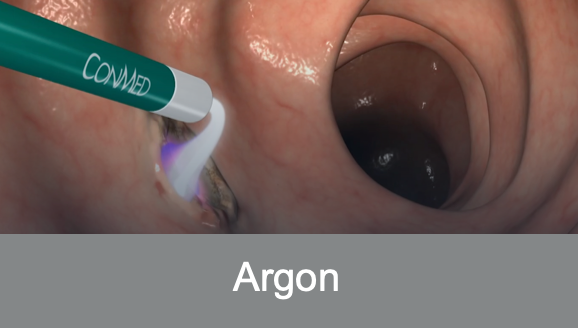 Argon-Animation Bild