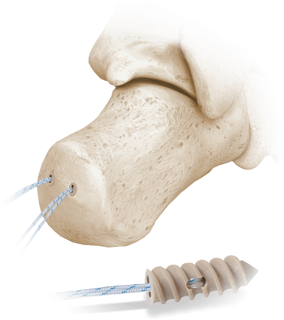 Hercules FT Diagrama de subprocesos completos